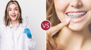 Difference Between a Dentist and an Orthodontist Gilbert AZ