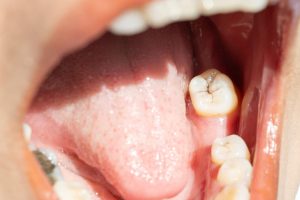 how oral health affects overall health