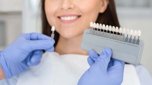 can teeth whitening damage dental work